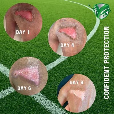 Turfguard Sterile Turf Burn Hydrogel Patch Wound Care